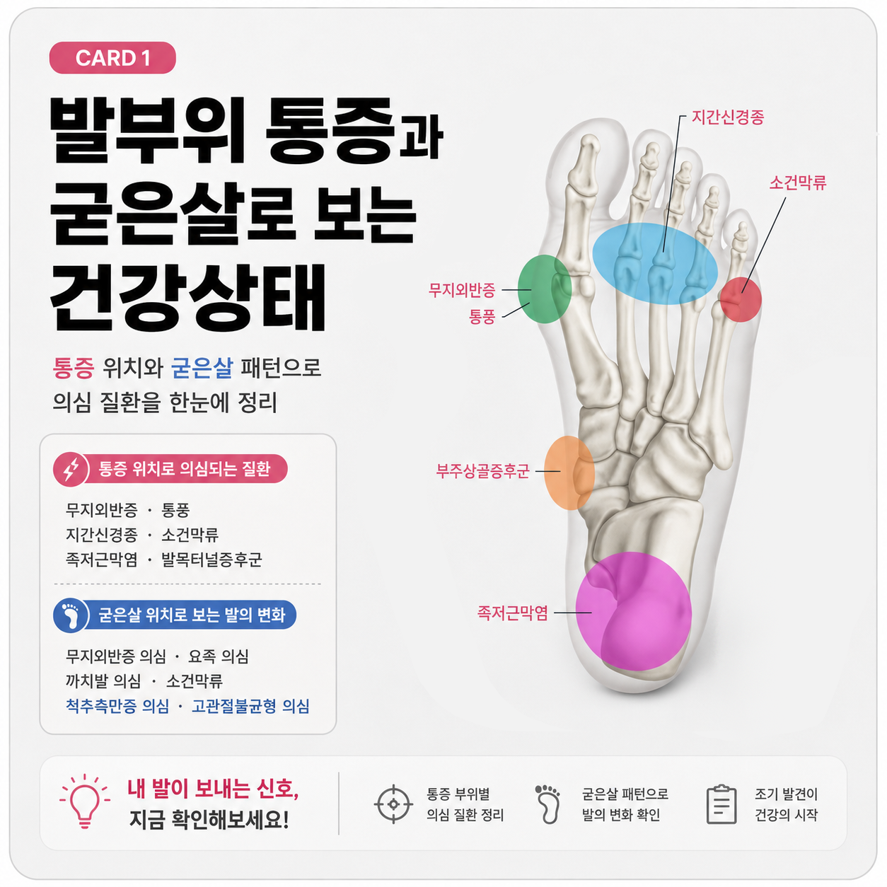 발바닥 통증과 굳은살 위치로 보는 건강 신호|앞발·뒤꿈치·저림 증상까지 정리